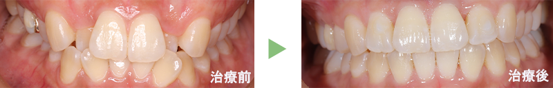 症例3