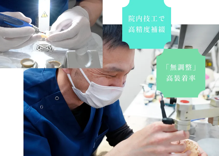 2 院内技工士常駐による高精度な補綴
